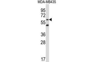 Western Blotting (WB) image for anti-Zinc Finger Protein 479 (ZNF479) antibody (ABIN5017203) (ZNF479 anticorps)