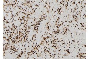 ABIN6272431 at 1/100 staining Human gastric tissue by IHC-P. (SIN3B anticorps  (Internal Region))