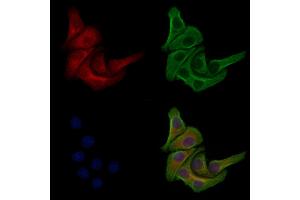 Phospho-PI3K p85 beta (Ser605) Antibody staining Hela cells(heat shock treatment) by IF/ICC. (PIK3R2 anticorps  (pSer605))