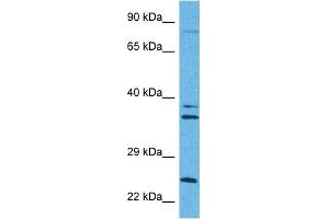 Host:  Rabbit  Target Name:  CPT1A  Sample Tissue:  Human MDA-MB-435s Whole Cell  Antibody Dilution:  1ug/ml