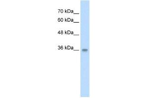 WB Suggested Anti-PP2447 Antibody Titration:  2. (TRABD anticorps  (N-Term))