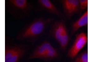Immunofluorescence staining of methanol-fixed Hela cells using MARCKS(Phospho-Ser162) Antibody.