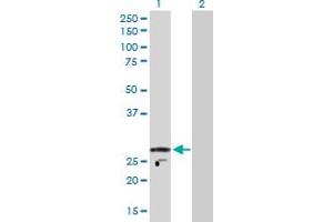 Western Blot analysis of KCNIP2 expression in transfected 293T cell line by KCNIP2 MaxPab polyclonal antibody. (KCNIP2 anticorps  (AA 1-270))