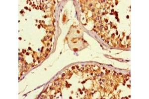 Immunohistochemistry of paraffin-embedded human testis tissue using ABIN7160774 at dilution of 1:100 (SMYD2A anticorps  (AA 115-272))