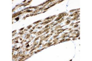 anti-Phospholamban (PLN) (AA 1-35), (N-Term) antibody