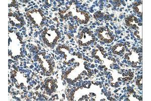 Image no. 1 for anti-Ribosomal Protein L8 (RPL8) (AA 155-204) antibody (ABIN203299)