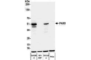 Western Blotting (WB) image for anti-Paired Box 8 (PAX8) (AA 225-275) antibody (ABIN7795777) (Recombinant PAX8 anticorps  (AA 225-275))
