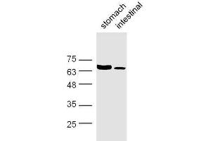 Mouse stomach and intestine lysates probed with Rabbit Anti-GABA Transporter 3/GAT 3 Polyclonal Antibody, Unconjugated  at 1:500 for 90 min at 37˚C.