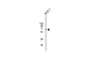 Anti-MDM2 Antibody at 1:4000 dilution + MCF-7 whole cell lysate Lysates/proteins at 20 μg per lane.