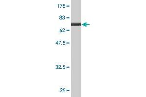 Western Blot detection against Immunogen (73.