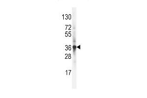 Western blot analysis of LDLR Antibody (C-term) (ABIN392554 and ABIN2842101) in NCI- cell line lysates (35 μg/lane).