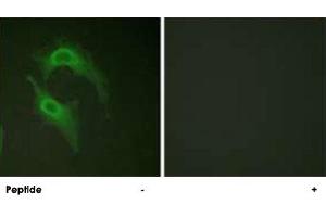 Immunofluorescence analysis of HeLa cells, using CD226 polyclonal antibody . (CD226 anticorps  (Ser329))