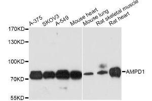 Western blot analysis of extracts of various cell lines, using AMPD1 antibody. (AMPD1 anticorps  (AA 50-260))