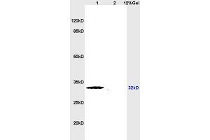 Lane 1: rat heart lysates Lane 2: rat brain lysates probed with Anti APG5L/ATG5 Polyclonal Antibody, Unconjugated (ABIN752413) at 1:200 in 4 °C. (ATG5 anticorps  (AA 101-200))
