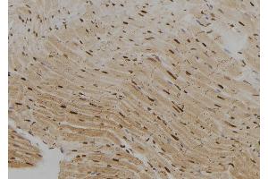 ABIN6262793 and ABIN6279426 at 1/100 staining Rat heart tissue by IHC-P.