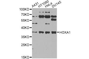 Western blot analysis of extracts of various cell lines, using HOXA1 antibody (ABIN2563217) at 1:1000 dilution. (HOXA1 anticorps)