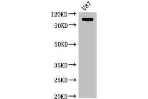 Western Blot Positive WB detected in: U87 whole cell lysate All lanes: HK2 antibody at 4 μg/mL Secondary Goat polyclonal to rabbit IgG at 1/50000 dilution Predicted band size: 103 kDa Observed band size: 103 kDa (Hexokinase 2 anticorps  (AA 334-526))