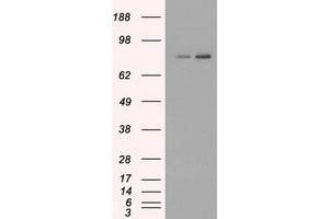 HEK293T cells were transfected with the pCMV6-ENTRY control (Left lane) or pCMV6-ENTRY FERMT2 (Right lane) cDNA for 48 hrs and lysed. (FERMT2 anticorps)