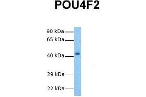 Host:  Rabbit  Target Name:  POU4F2  Sample Tissue:  Human Fetal Liver  Antibody Dilution:  1. (POU4F2 anticorps  (N-Term))