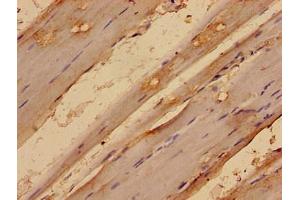 Immunohistochemistry analysis of human skeletal muscle tissue using ABIN7159132 at dilution of 1:100 (MED24 anticorps  (AA 1-300))