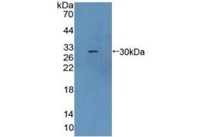 Detection of Recombinant CBR1, Mouse using Polyclonal Antibody to Carbonyl Reductase 1 (CBR1) (CBR1 anticorps  (AA 66-271))