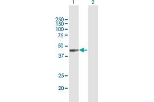 Western Blot analysis of MICB expression in transfected 293T cell line by MICB MaxPab polyclonal antibody. (MICB anticorps  (AA 1-340))