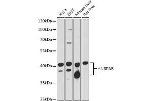 Western blot analysis of extracts of various cell lines, using HNRPAB antibody (ABIN7267625) at 1:1000 dilution. (HNRNPAB anticorps  (AA 1-285))