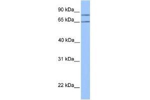 OXCT2 antibody used at 1 ug/ml to detect target protein.