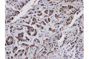 IHC-P Image Immunohistochemical analysis of paraffin-embedded A549 xenograft, using PPP2CA , antibody at 1:100 dilution. (PPP2CA anticorps  (C-Term))