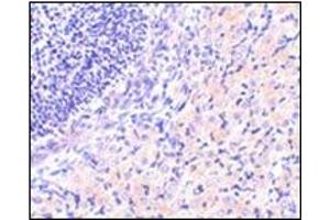 anti-RPA Interacting Protein (RPAIN) (C-Term) antibody