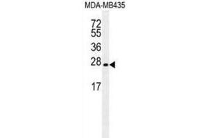Western Blotting (WB) image for anti-Lin-28 Homolog A (C. Elegans) (LIN28A) antibody (ABIN2996249) (LIN28A anticorps)