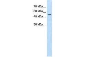 Image no. 1 for anti-ATP-Binding Cassette, Sub-Family D (Ald), Member 4 (ABCD4) (AA 451-500) antibody (ABIN396878) (ABCD4 anticorps  (AA 451-500))