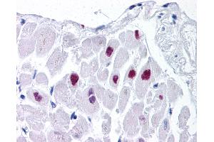 Anti-HDAC2 antibody IHC of human heart.