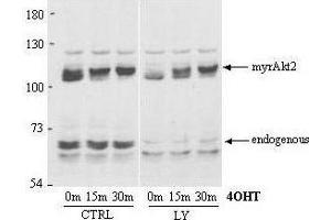 Western Blot of Rabbit Anti-AKT2 antibody. (AKT2 anticorps  (AA 455-468))
