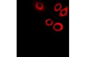 Immunofluorescent analysis of SerpinB1 staining in Hela cells.