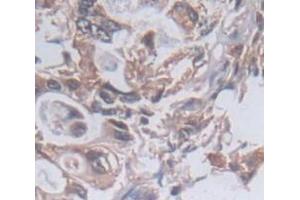 IHC-P analysis of Human Tissue, with DAB staining. (PKN2 anticorps  (AA 323-464))