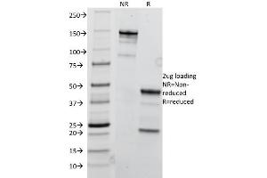 SDS-PAGE Analysis Purified TRIM29 Mouse Monoclonal Antibody (TRIM29/1041).