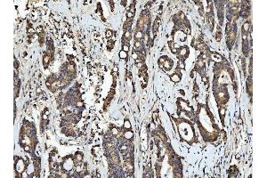 IHC analysis of RGS12 using anti-RGS12 antibody (ABIN7602410). (RGS12 anticorps  (AA 746-995))