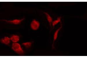 ABIN6274361 staining Hela by IF/ICC. (CDK5R1 anticorps  (N-Term))