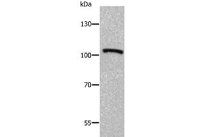 Western Blotting (WB) image for anti-ADAM Metallopeptidase with thrombospondin Type 1 Motif, 5 (ADAMTS5) antibody (ABIN2425574) (ADAMTS5 anticorps)
