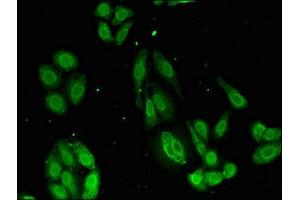 Immunofluorescent analysis of HepG2 cells using ABIN7146302 at dilution of 1:100 and Alexa Fluor 488-congugated AffiniPure Goat Anti-Rabbit IgG(H+L)