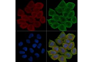 ABIN6266234 and ABIN6277388 staining Hela cells(30 min of UV treatment) by IF/ICC. (IGFBP7 anticorps  (Internal Region))