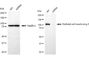 Western blotting analysis using epithelial cell transforming 2 antibody (ABIN7798482). (ECT2 anticorps)