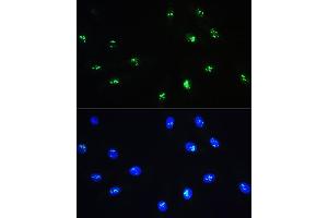Immunofluorescence analysis of H9C2 cells using NOP58 Rabbit pAb (ABIN1681073, ABIN3019190, ABIN3019191 and ABIN6220753) at dilution of 1:100. (NOP58 anticorps  (AA 360-529))
