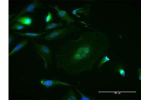 Immunofluorescence of purified MaxPab antibody to MAPK8 on HeLa cell.