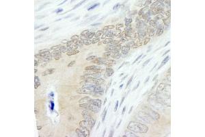 Immunohistochemistry (IHC) image for anti-HECT, UBA and WWE Domain Containing 1, E3 Ubiquitin Protein Ligase (HUWE1) (AA 2250-2300) antibody (ABIN7448629)