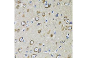 Immunohistochemistry of paraffin-embedded rat brain using RPS10 antibody.