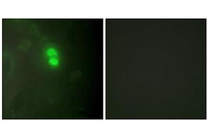 Immunofluorescence analysis of HeLa cells, using Dyskerin antibody. (DKC1 anticorps  (Internal Region))