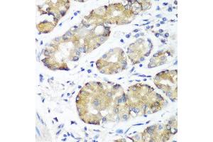 Immunohistochemistry of paraffin-embedded human stomach using NOTCH2 antibody at dilution of 1:100 (40x lens). (NOTCH2 anticorps)