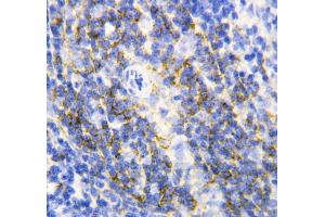 Anti-Annexin VI antibody, IHC(P) IHC(P): Rat Spleen Tissue (ANXA6 anticorps  (C-Term))